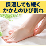 保湿しても続くかかとのひび割れについて、日常ケアと受診の目安を紹介
