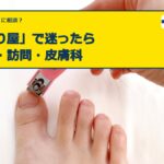 「爪切り屋」で迷ったら｜サロン・訪問・皮膚科