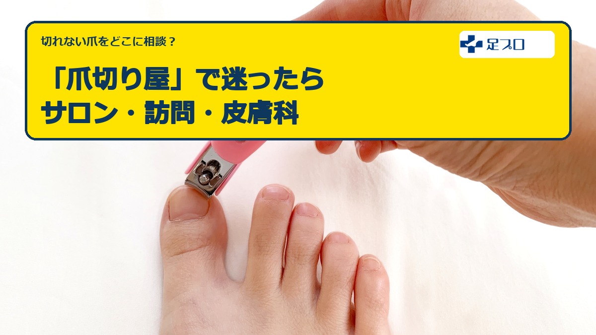 「爪切り屋」で迷ったら｜サロン・訪問・皮膚科