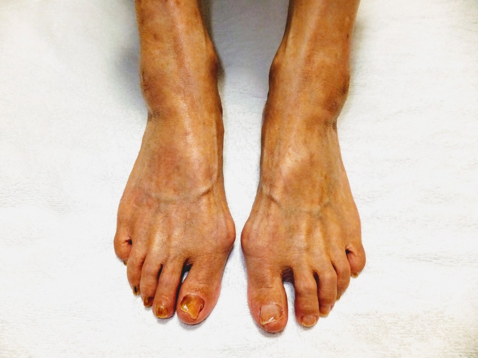 足爪の長さと爪周囲の皮膚を観察するイメージ
