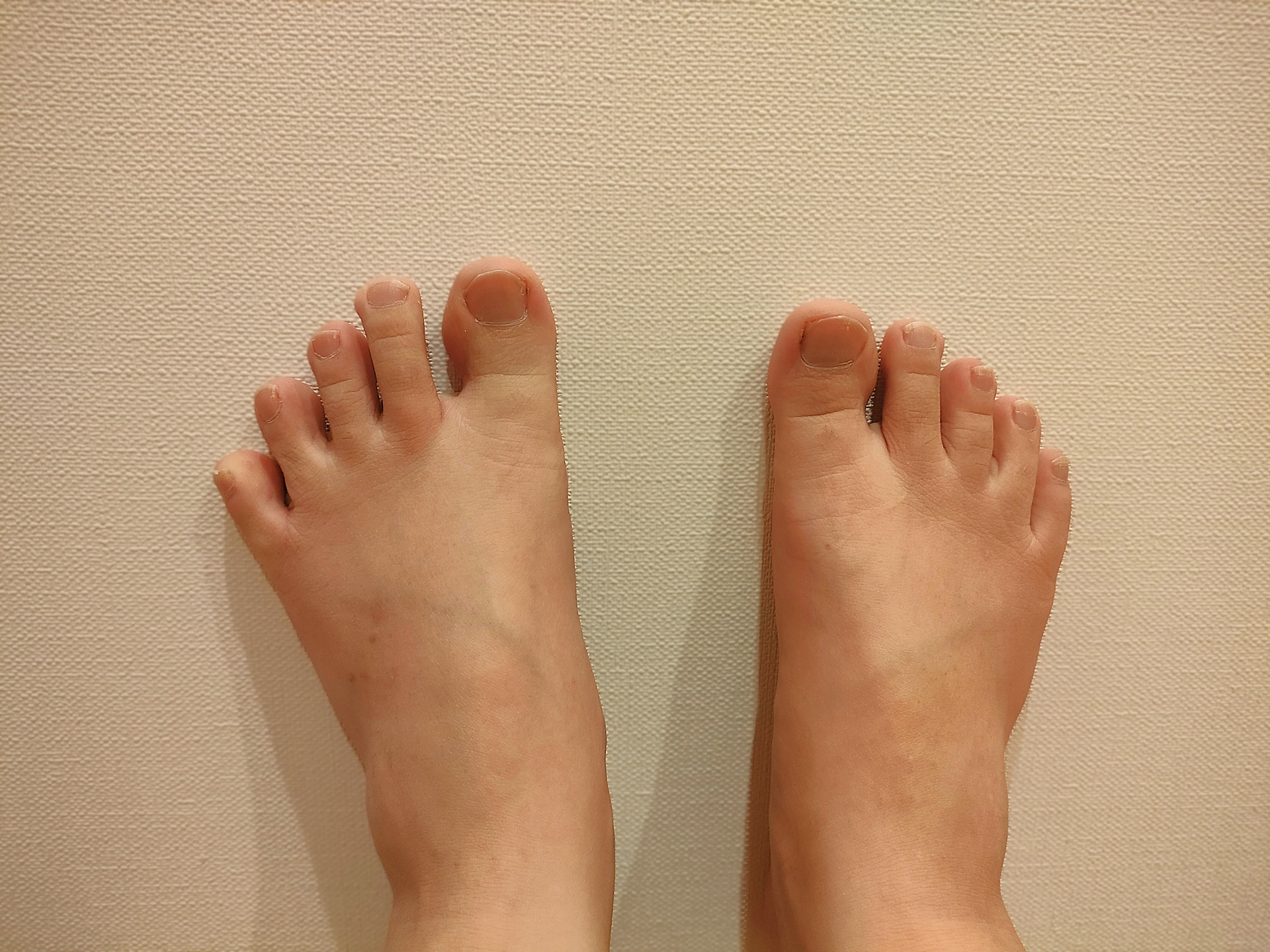 親指から第3趾までの長さが近い足先を確認する様子