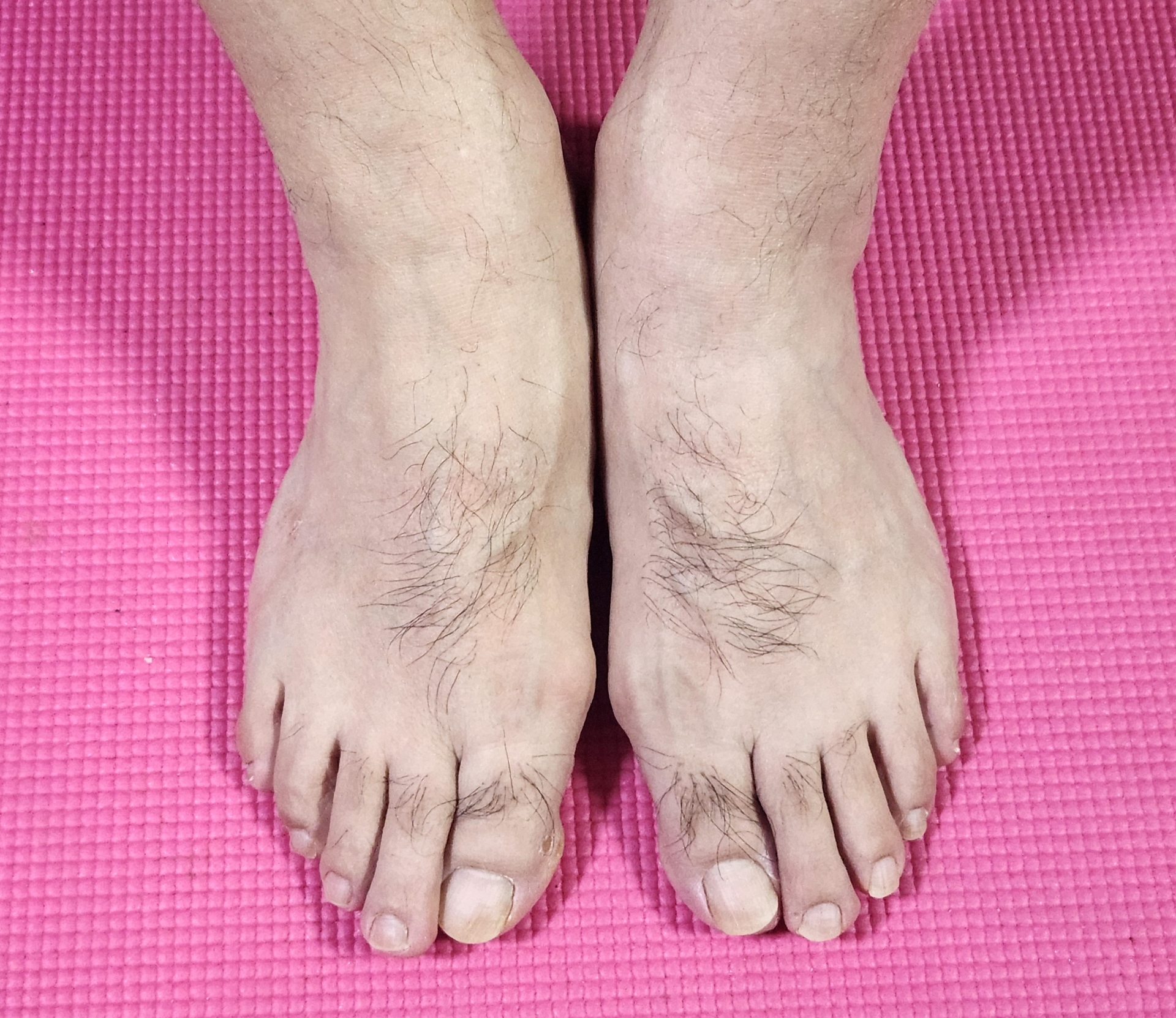 高齢男性の足元